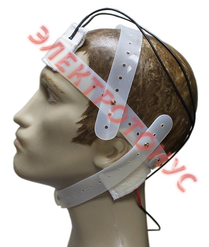 Нозологический электродный трафарет №2